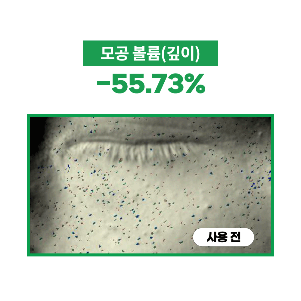 S.Nature Aqua Squalane Moisture Cream 60ml Set (60ml + 30ml) detail 31